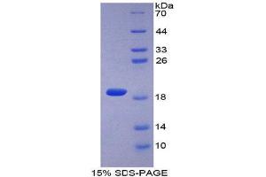 SDS-PAGE (SDS) image for Collagen, Type II, alpha 1 (COL2A1) (AA 677-817) protein (GST-His-Tag) (ABIN1877763)
