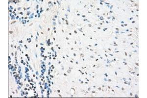 Image no. 1 for anti-Protein Phosphatase 5, Catalytic Subunit (PPP5C) antibody (ABIN1500391)