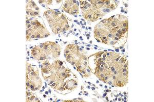 Immunohistochemistry (IHC) image for anti-Chitotriosidase (CHIT1) (AA 217-466) antibody (ABIN3015833)