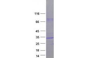 Validation with Western Blot
