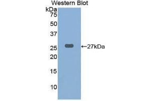 Western Blotting (WB) image for anti-Cathepsin K (CTSK) (AA 115-329) antibody (ABIN1858550) (Cathepsin K anticorps  (AA 115-329))