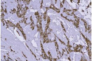 IHC analysis of Annexin-4/ANXA4 using anti-Annexin-4/ANXA4 antibody (ABIN7599265).