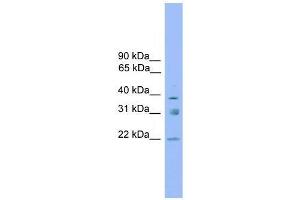 Western Blot showing RNF167 antibody used at a concentration of 1-2 ug/ml to detect its target protein. (RNF167 anticorps  (Middle Region))