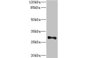 Western blot All lanes: ICAM4 antibody at 4. (ICAM4 anticorps  (AA 20-140))