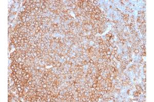 Formalin-fixed, paraffin-embedded human Tonsil stained with HLA-Pan Rabbit Recombinant Monoclonal Antibody (HLA-Pan/2967R).