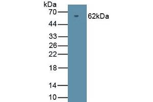 Detection of Recombinant PRKG2, Human using Polyclonal Antibody to Protein Kinase, cGMP Dependent Type II (PRKG2) (PRKG2 anticorps  (AA 453-728))
