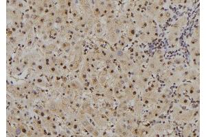 ABIN6261667 and ABIN6277489 at 1/100 staining Human liver tissue by IHC-P. (FAM160B2 anticorps  (Internal Region))