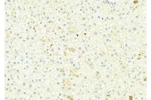ABIN6275152 at 1/100 staining Mouse liver tissue by IHC-P.