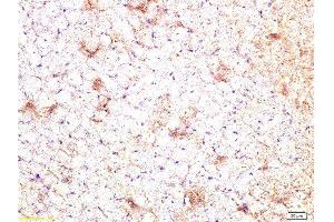 Formalin-fixed and paraffin embedded rat heart tissue labeled Anti-CTGF Polyclonal Antibody, Unconjugated  at 1:200, followed by conjugation to the secondary antibody and DAB staining