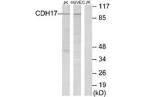 Western Blotting (WB) image for anti-LI Cadherin (AA 341-390) antibody (ABIN2889878) (LI Cadherin anticorps  (AA 341-390))