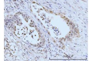 IHC analysis of SBNO1 using anti-SBNO1 antibody (ABIN7601710). (SBNO1 anticorps  (AA 43-1303))