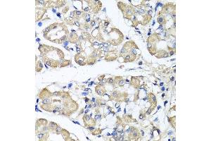Immunohistochemistry of paraffin-embedded human stomach using BCS1L antibody.