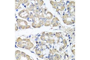 Immunohistochemistry of paraffin-embedded human stomach using BCS1L antibody. (BCS1L anticorps  (AA 33-240))