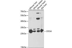 Western blot analysis of extracts of various cell lines, using STOM antibody (ABIN6132877, ABIN6148626, ABIN6148628 and ABIN6221992) at 1:1000 dilution. (Stomatin anticorps  (AA 55-288))