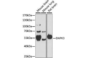 Western blot analysis of extracts of various cell lines, using D antibody (ABIN7266712) at 1:1000 dilution.