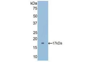 Western blot analysis of recombinant Rat CUBN. (CUBN anticorps  (AA 3157-3274))