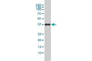 F11R monoclonal antibody (M01), clone 2E3-1C8 Western Blot analysis of F11R expression in HepG2 .