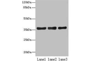 Western blot All lanes: UPP2 antibody at 4 μg/mL Lane 1: Mouse kidney tissue Lane 2: Mouse brain tissue Lane 3: Hela whole cell lysate Secondary Goat polyclonal to rabbit IgG at 1/10000 dilution Predicted band size: 36, 42 kDa Observed band size: 36 kDa (UPP2 anticorps  (AA 1-317))