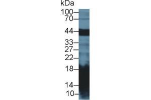 Western Blot; Sample: Mouse Pancreas lysate; Primary Ab: 2µg/ml Rabbit Anti-Rat REG1a Antibody Second Ab: 0. (REG1A anticorps  (AA 22-165))