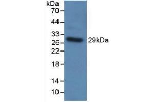 Detection of Recombinant TLR5, Human using Polyclonal Antibody to Toll Like Receptor 5 (TLR5) (TLR5 anticorps  (AA 303-514))