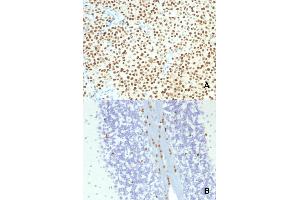 Immunohistochemical staining (Formalin-fixed paraffin-embedded sections) of (A) human melanoma and (B) mouse brain with SOX10 monoclonal antibody, clone SOX10/1074 . (SOX10 anticorps  (AA 115-269))