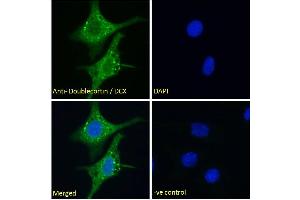 (ABIN6391364) Immunofluorescence analysis of paraformaldehyde fixed HepG2 cells, permeabilized with 0. (Doublecortin anticorps  (AA 69-81))