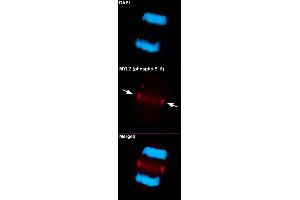 Immunofluorescent staining of methanol-fixed U87 cells using MYL2 (phospho S15) polyclonal antibody  at 1:100-1:200 dilution. (MYL2 anticorps  (pSer15))