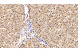 Detection of INSR in Human Liver Tissue using Monoclonal Antibody to Insulin Receptor (INSR)