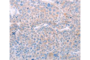 Immunohistochemistry (IHC) image for anti-Spermatogenesis Associated 6 (SPATA6) antibody (ABIN2422311) (SPATA6 anticorps)