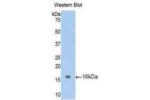 Western Blotting (WB) image for anti-Endoglin (ENG) (AA 27-137) antibody (ABIN1174028) (Endoglin anticorps  (AA 27-137))