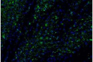 Image no. 2 for anti-Chemokine (C-C Motif) Ligand 2 (CCL2) antibody (ABIN465001)