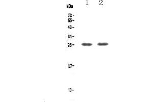 Western blot analysis of TNFRSF18 using anti-TNFRSF18 antibody .