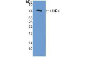 Detection of Recombinant PCT, Mouse using Polyclonal Antibody to Procalcitonin (PCT) (Procalcitonin anticorps  (AA 26-136))