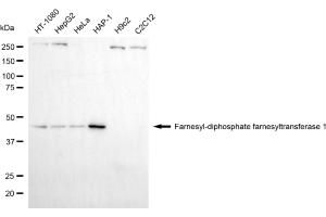Western blotting analysis using farnesyl-diphosphate farnesyltransferase 1 antibody (ABIN7798571). (FDFT1 anticorps)