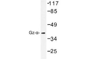 Image no. 1 for anti-Guanine Nucleotide Binding Protein (G Protein), alpha Z Polypeptide (GNaZ) antibody (ABIN317793) (GNaZ anticorps)
