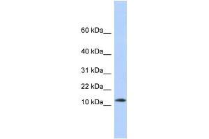 WB Suggested Anti-MAP1LC3A Antibody Titration:  0.