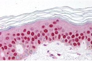 Human Skin (formalin-fixed, paraffin-embedded) stained with GDF9 antibody ABIN214650 at 10 ug/ml followed by biotinylated goat anti-rabbit IgG secondary antibody ABIN481713, alkaline phosphatase-streptavidin and chromogen. (GDF9 anticorps  (AA 45-59))
