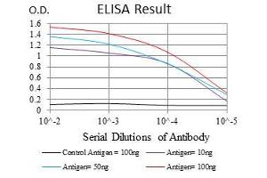 Black line: Control Antigen (100 ng), Purple line: Antigen(10 ng), Blue line: Antigen (50 ng), Red line: Antigen (100 ng),