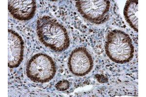 IHC-P Image PCNA antibody detects PCNA protein at nucleus in human colon by immunohistochemical analysis. (PCNA anticorps)
