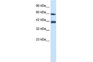 WB Suggested Anti-TRIM31 Antibody Titration:  0.