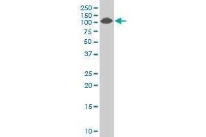 COL4A3BP polyclonal antibody (A01), Lot # 060113JC01 Western Blot analysis of COL4A3BP expression in Jurkat .