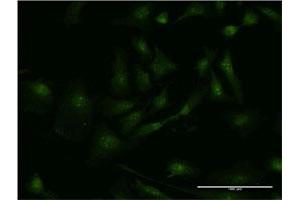 Immunofluorescence of monoclonal antibody to SMAD3 on HeLa cell.