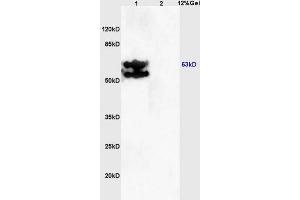 Lane 1: mouse embryo lysates Lane 2: mouse brain lysates probed with Anti PRKAG2/AMPK? (AMPK gamma 1/2/3 (AA 280-330) anticorps)