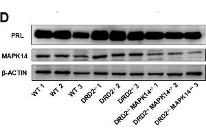 Effects of MAPK14 knockout on the development of prolactinoma in DRD2-/- mice. (beta Actin anticorps)