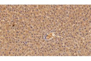Detection of ANG in Rat Liver Tissue using Polyclonal Antibody to Angiogenin (ANG)