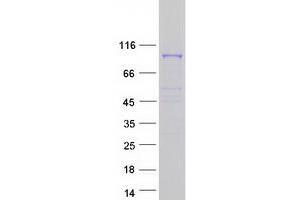 Validation with Western Blot