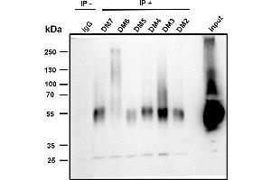 Immunoprecipitation analysis.