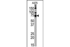 Western blot analysis of HDAC10 polyclonal antibody  in A-375 cell line lysates. (HDAC10 anticorps  (AA 1-100))