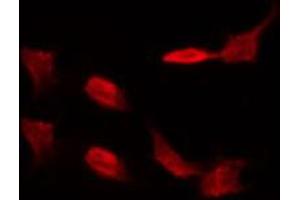 ABIN6274578 staining lOVO by IF/ICC. (alpha 1 Adrenergic Receptor anticorps  (Internal Region))