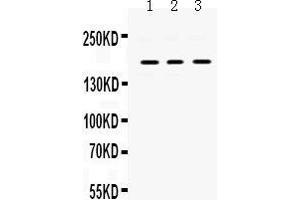 Western Blotting (WB) image for anti-Platelet Derived Growth Factor Receptor alpha (PDGFRA) (AA 968-1002), (C-Term) antibody (ABIN3043897)